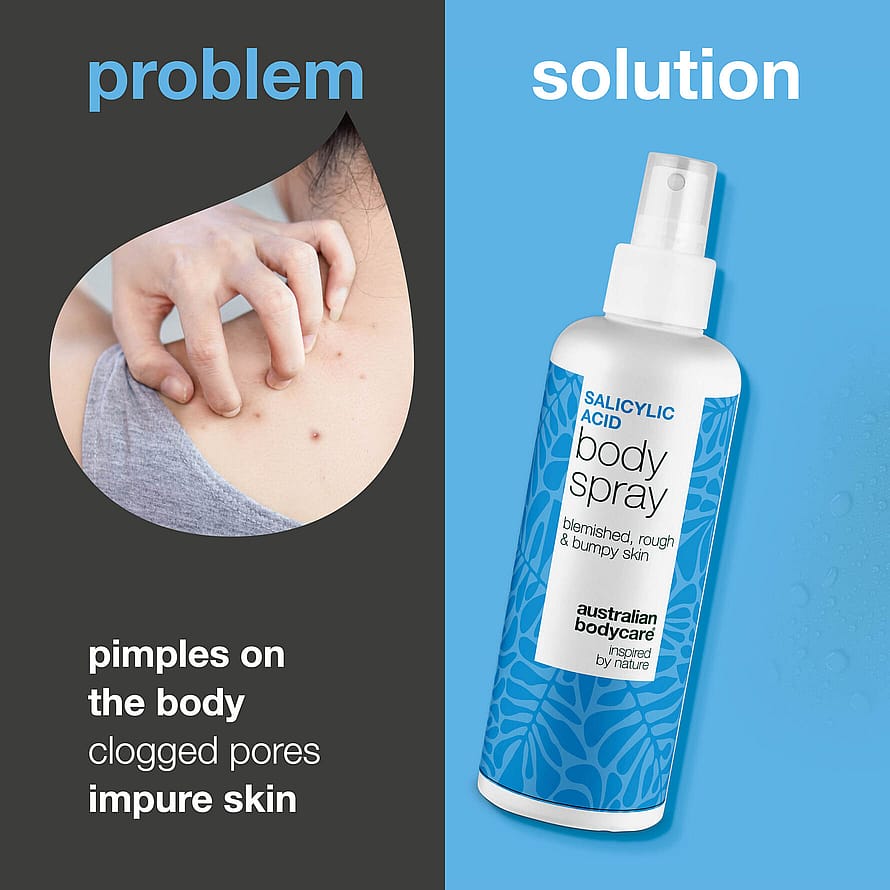 Spray med salicylsyra för finnar och tilltäppta porer 250 ml